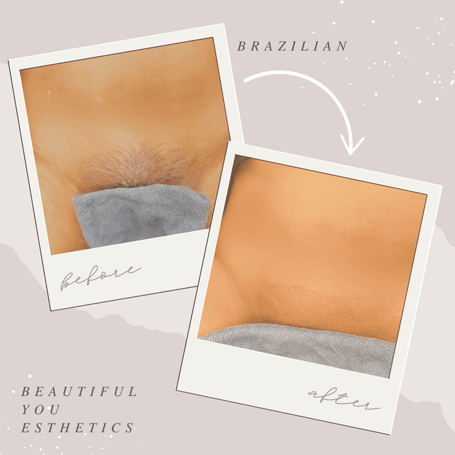 Brazilian Wax Buy 3 Get 4th Free at Beautiful You Esthetics in Gilbert, AZ